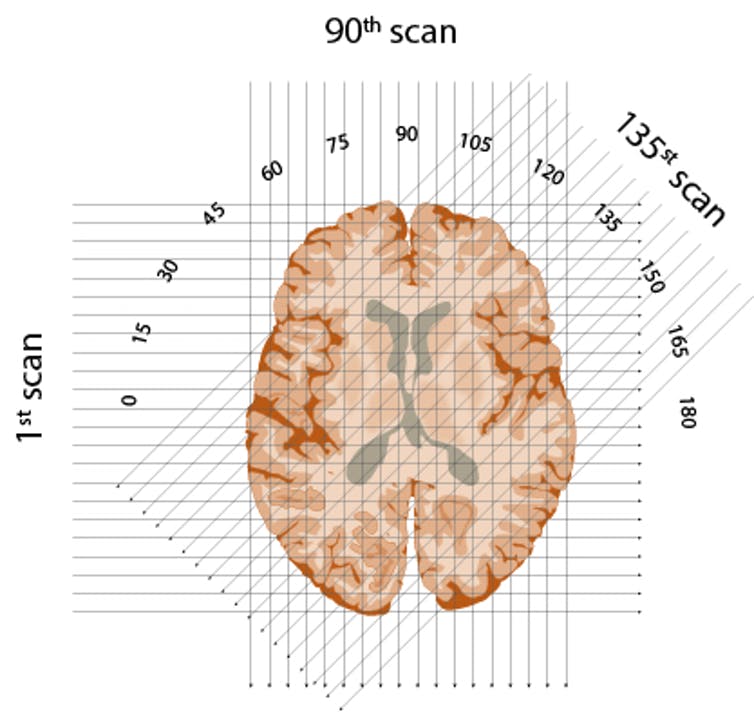 schematische weergave van drie röntgenstralen door één 'plakje' hersenen