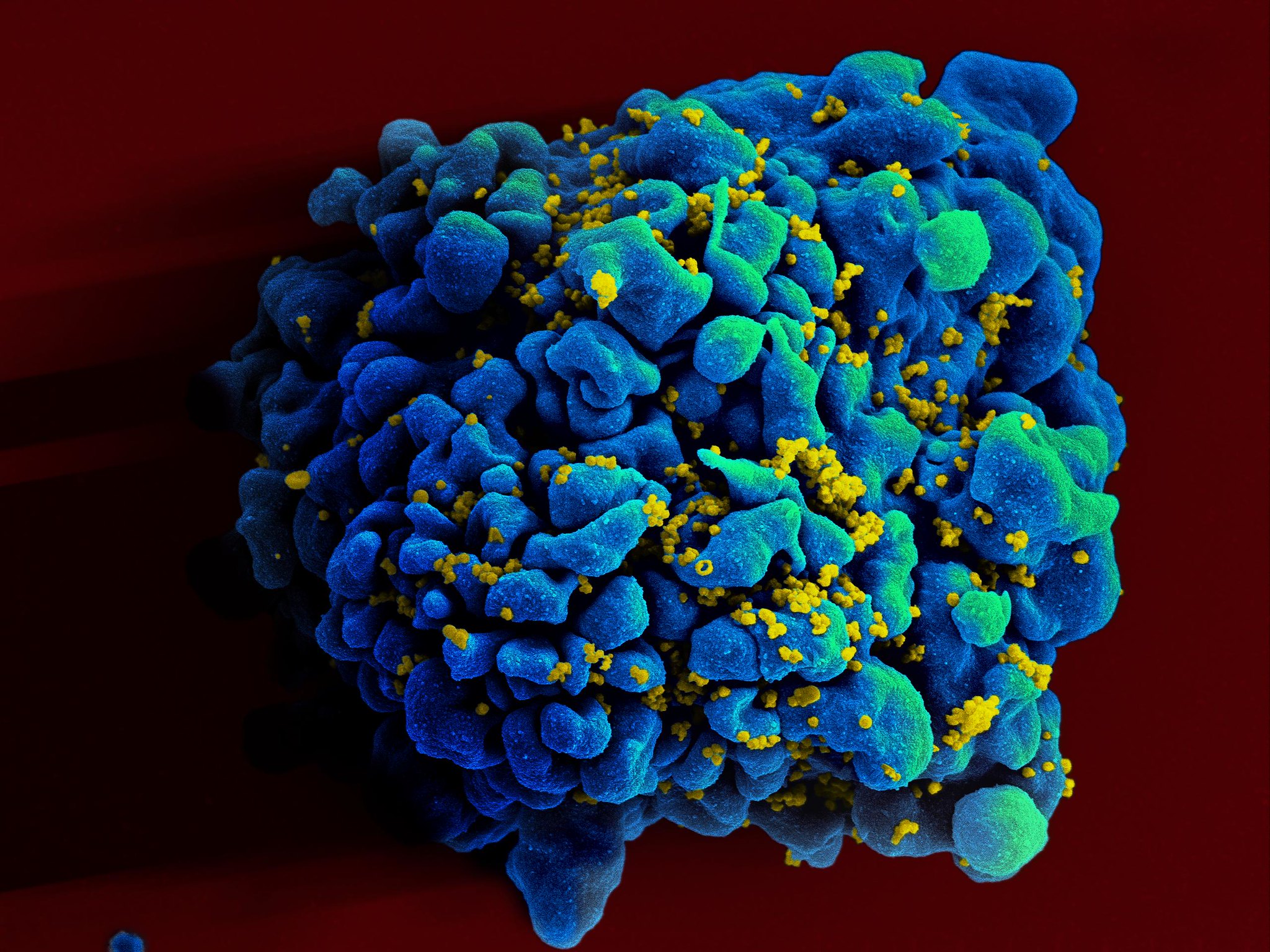 HIV-aangetaste cel